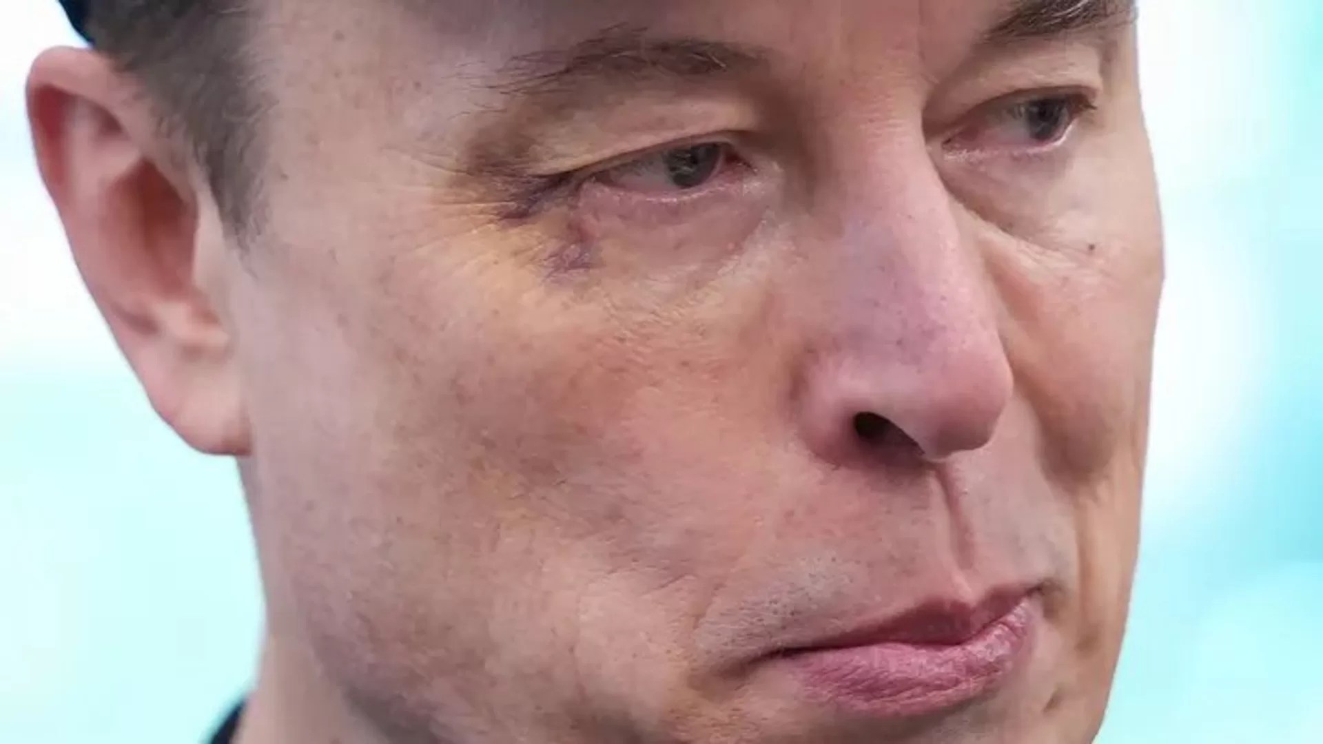 “Elon Musk Shows Up With Black Eye at White House—Blames 5-Year-Old Son!”