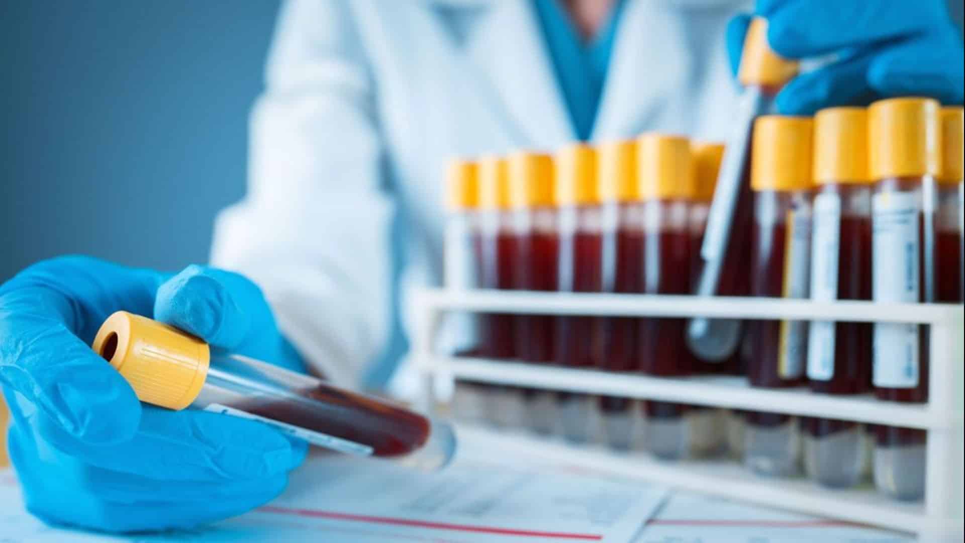 ME/CFS Blood Test Shows 96% Accuracy in New Study | Technology Networks