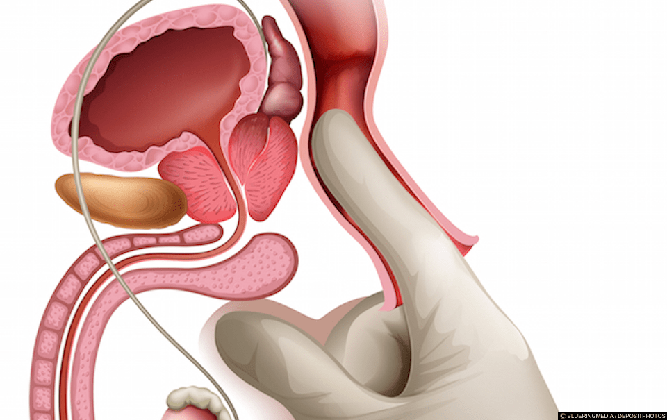 Is it safe to bottom after prostate surgery? 6