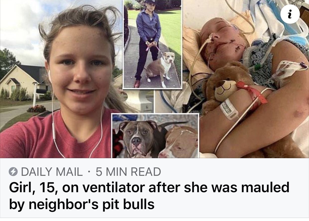WARNING! Graphic Photos/Videos of Pit Bull Victims Responsible