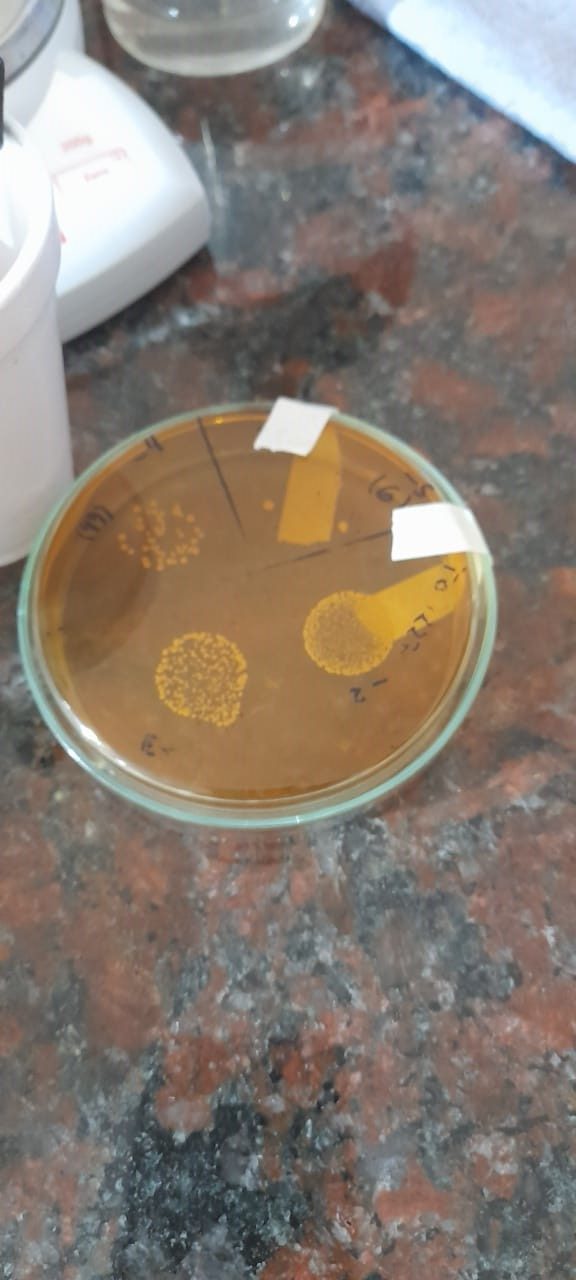 Muestra bacterias