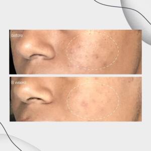 Dermalogica PowerBright Dark Spot Serum - Image 4