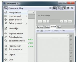 Error Report During Eeg Decoding Bugs Brainstorm - Classic Ultra HD City Wallpapers | Free Download