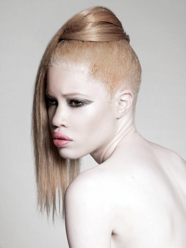 Overview blindness is the inability to see anything, including light. TRIP DOWN MEMORY LANE: ALBINOS IN AFRICA