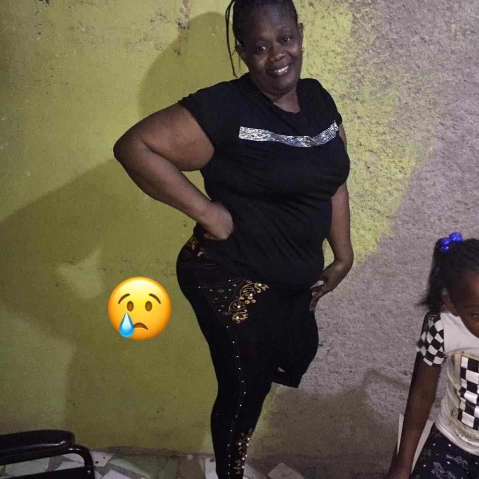 Help Me Please..I need a prosthetic leg!