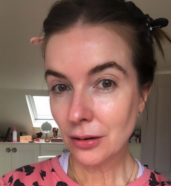 View 22 Augustinus Bader Before And After foescesz