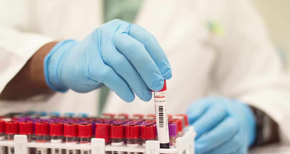 31. THE BLOOD OF JESUS GIVES SPIRITUAL LIFE