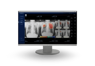 X-ray Imaging System