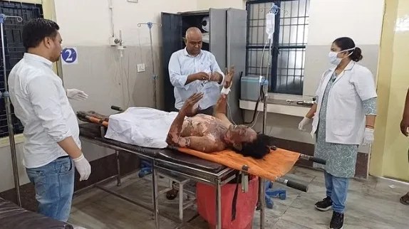 मालगाड़ी की छत पर चढ़ा नेपाली, डंडे से बिजली की तारों को हिलाने लगा, बुरी तरह झुलसा 5 WhatsApp Image 2024 05 23 at 18.54.22 jpeg