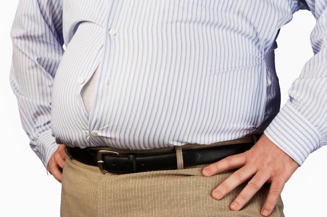 Obesitas Gejala Penyebab Dan Mengobati Alodokter