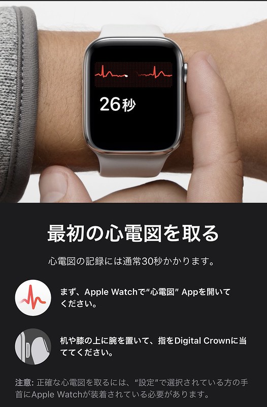 electrocardiogram on Apple Watch electrocardiogram on Apple Watch