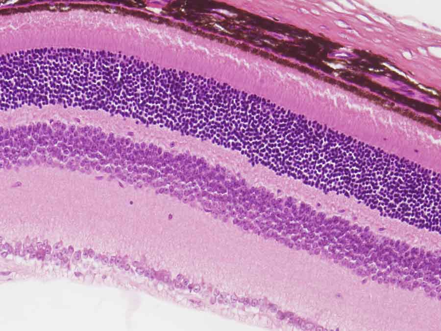 Harnessing immune privilege in the eye to combat