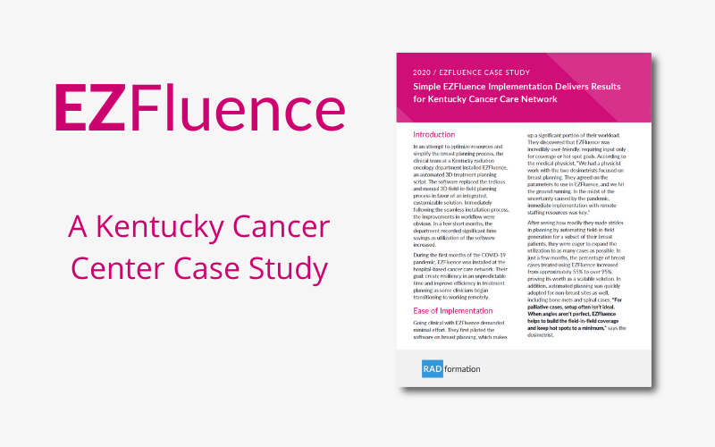 Ucsd Ezfluence Case Study Resource - Download High Quality Light Texture | 8K