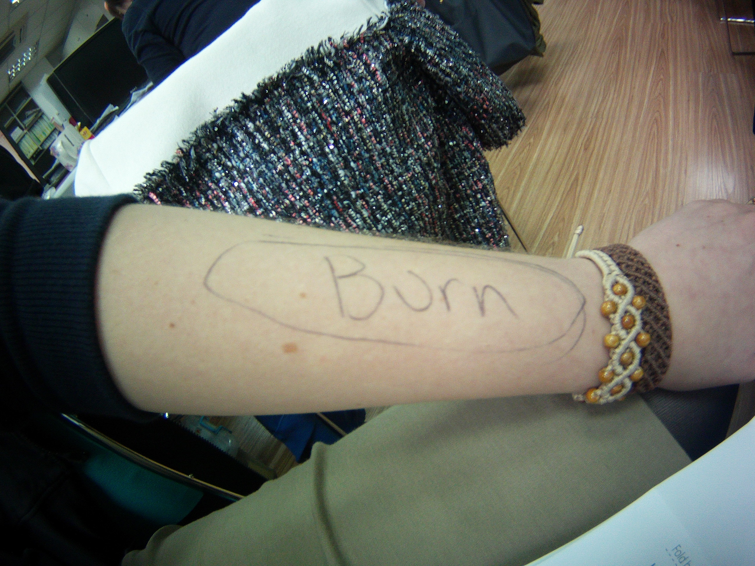 I wrote on my arm to help students with medical terms