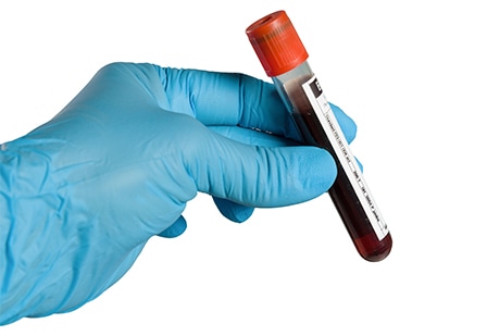hemostatic efficacy
