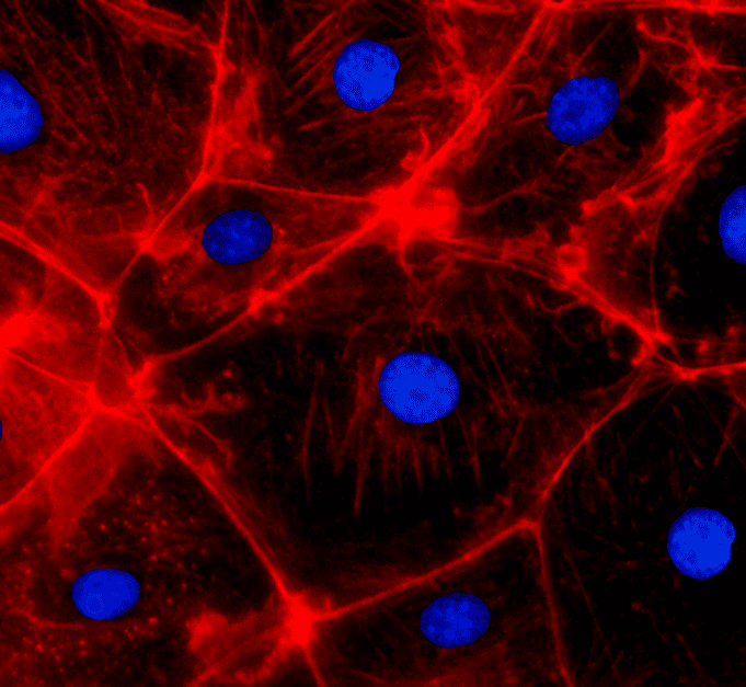 Engineered tissue