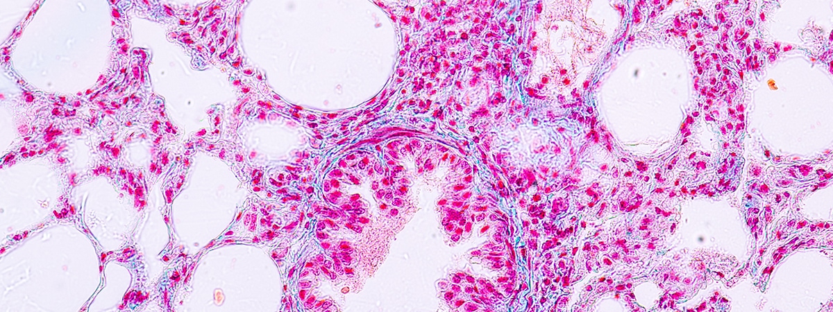 microscopic structure of lungs