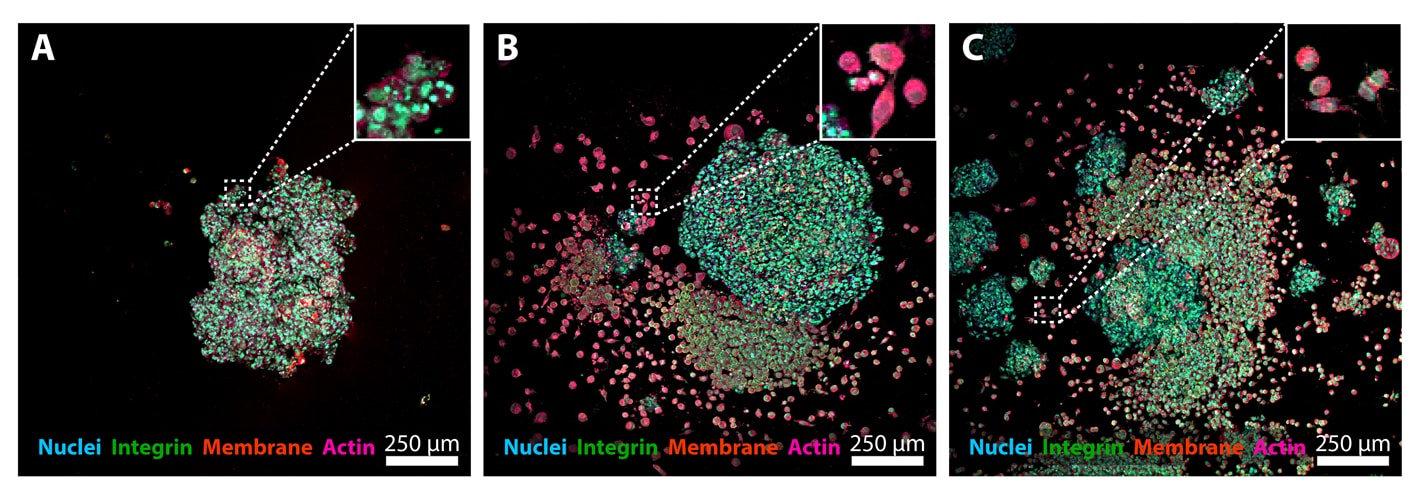 Breast cancer cell behavior on LunaGel ECMs of varying stiffness