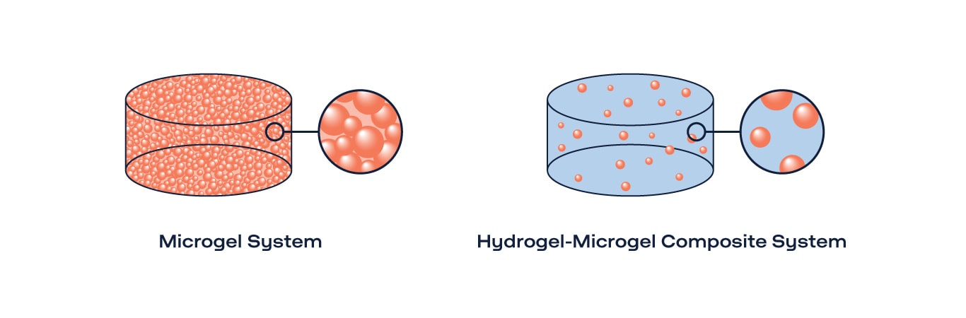 Illustration of Microgel System and Hydrogel-Microgel Composite System