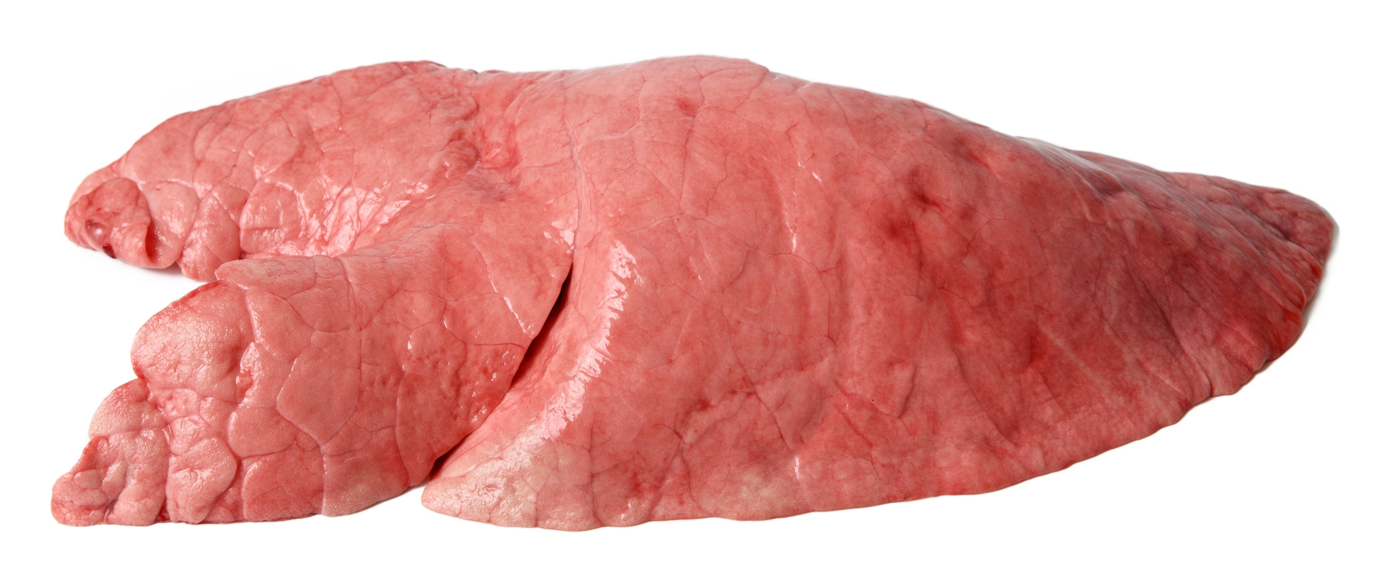 Lung tissue sample.