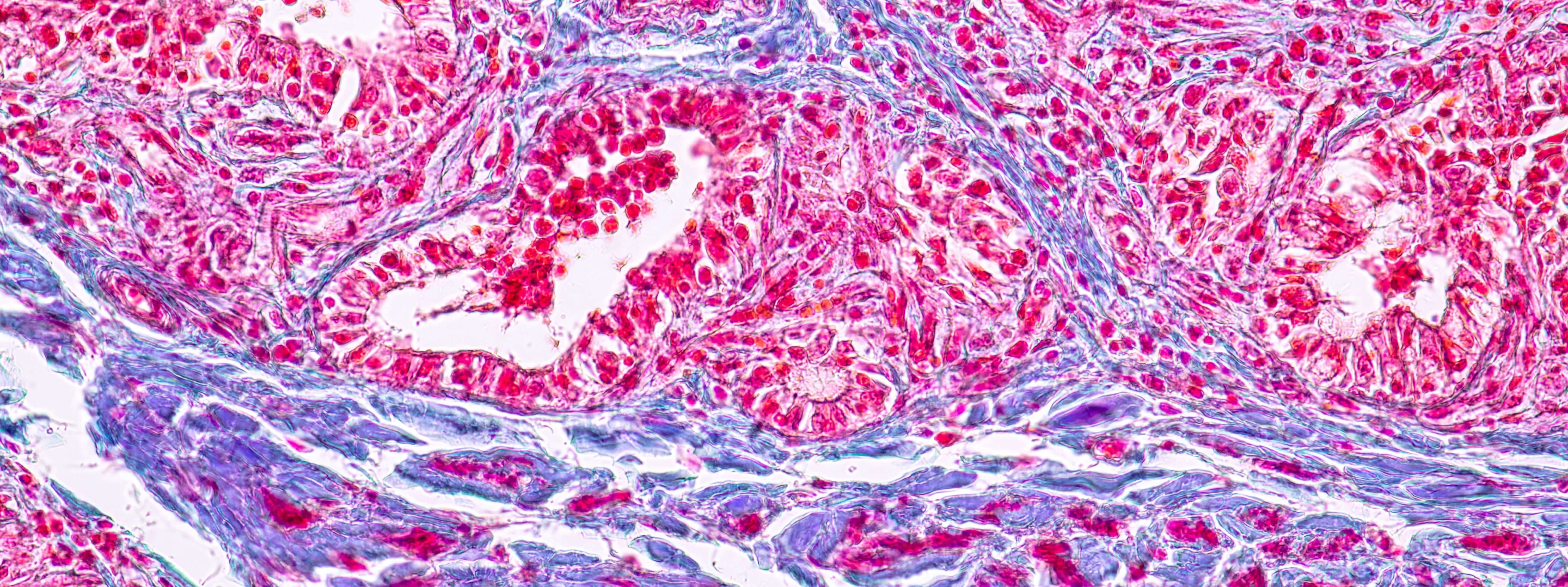 Measuring mechanical properties of breast tissue