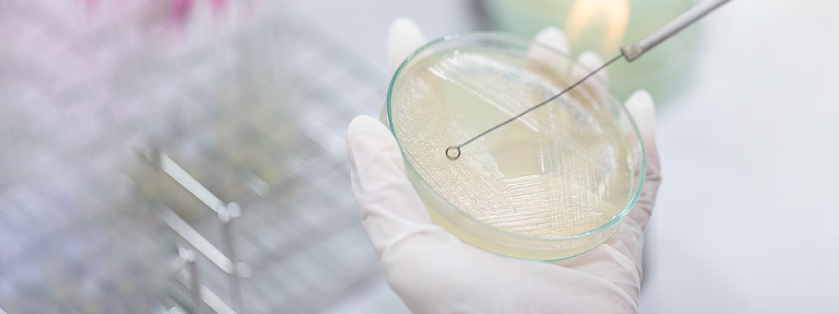 Yeast Growth Monitoring with TURBIDI.T™ in Bioreactor - Blog Post Image