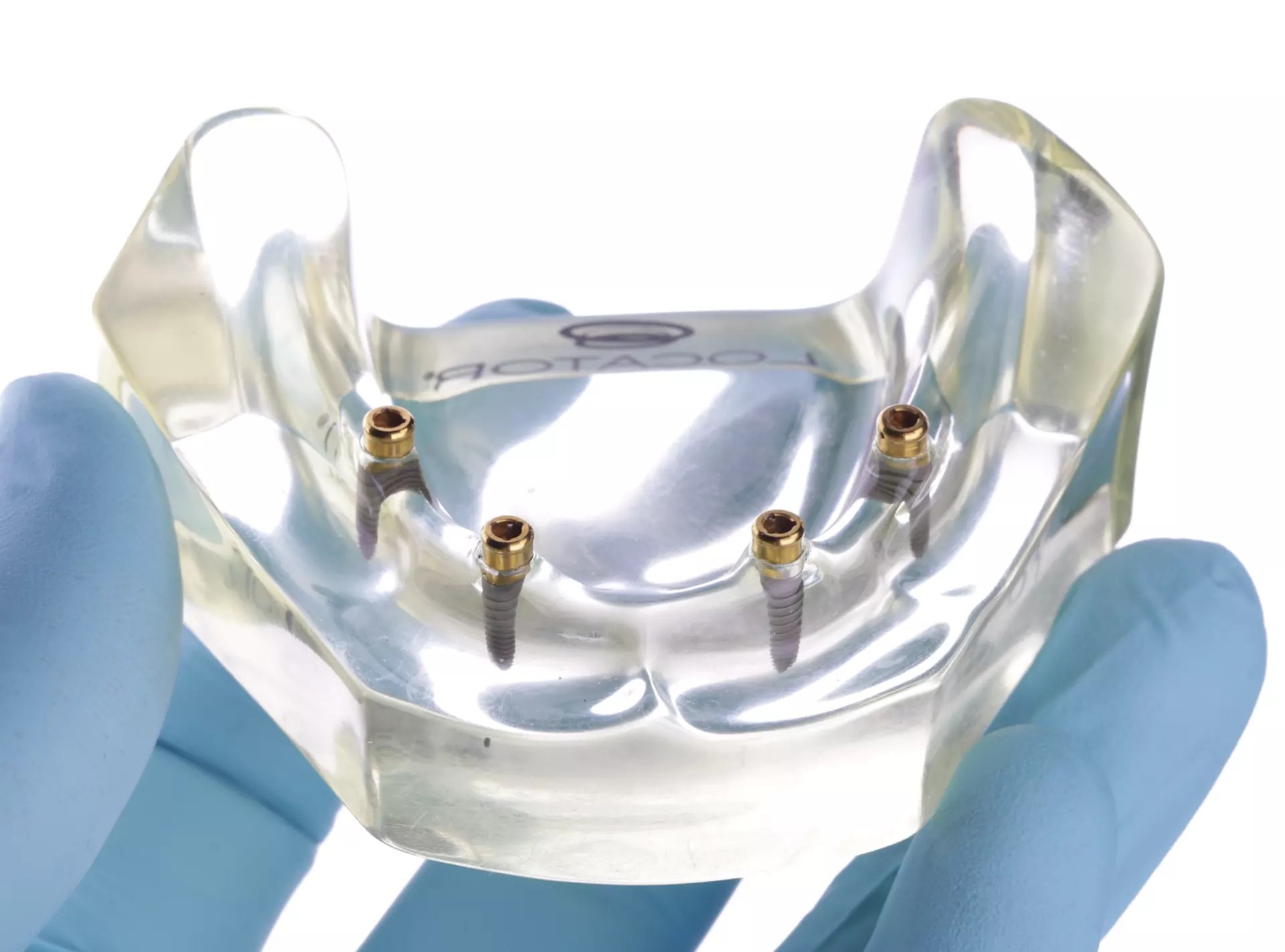 Transparent dental model showing lower jaw implants with locator attachments for snap-in dentures