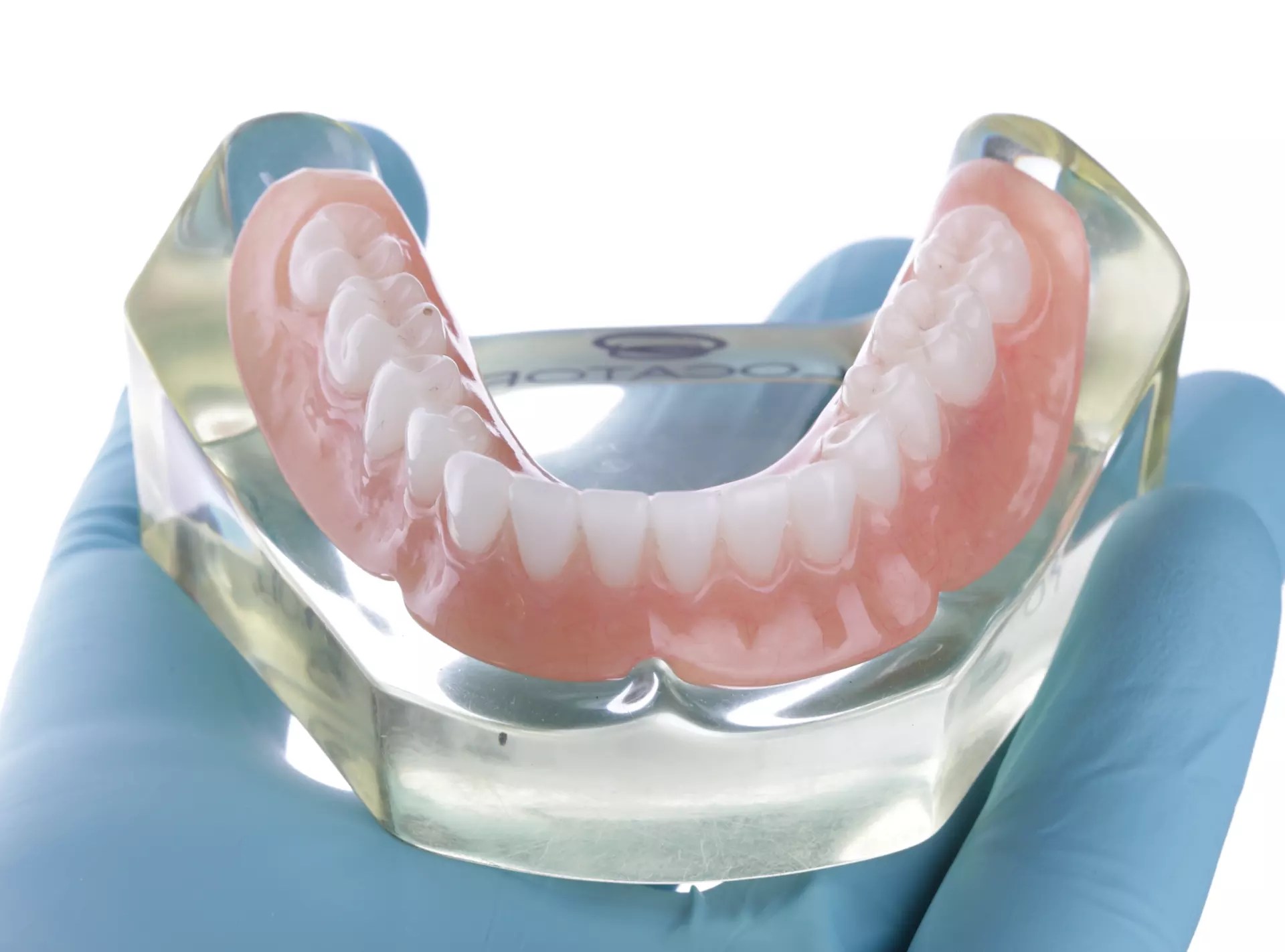 Lower snap-in overdenture seated on a transparent dental model to demonstrate implant fit and anatomy
