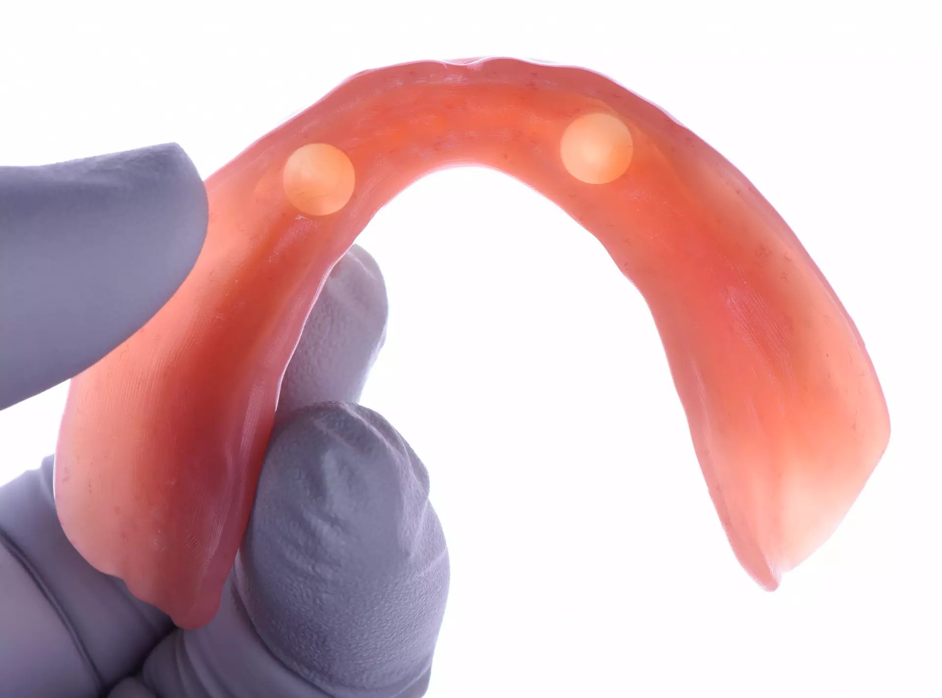 Intaglio surface of an overdenture model showing locator attachment housings