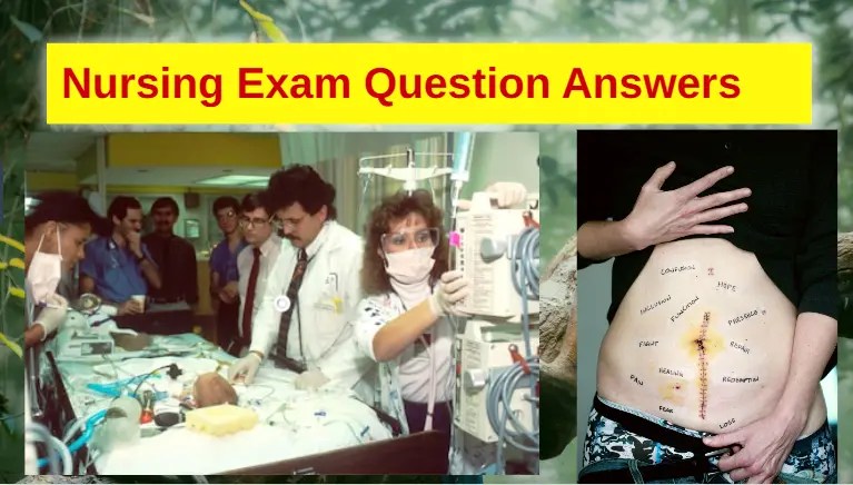 Nursing Exam Question Answers 1 Nursing Exam Question Answers