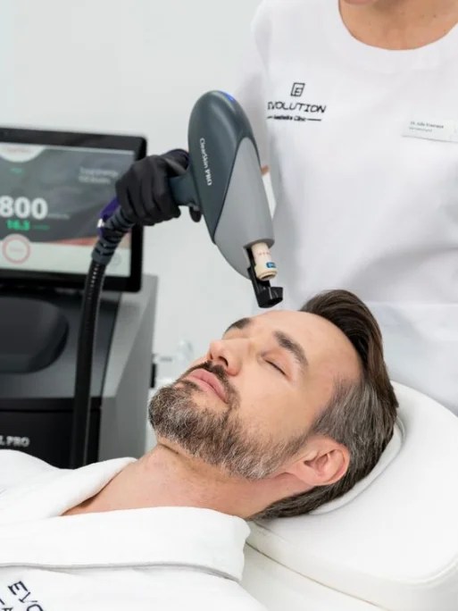 Active-acne laser session