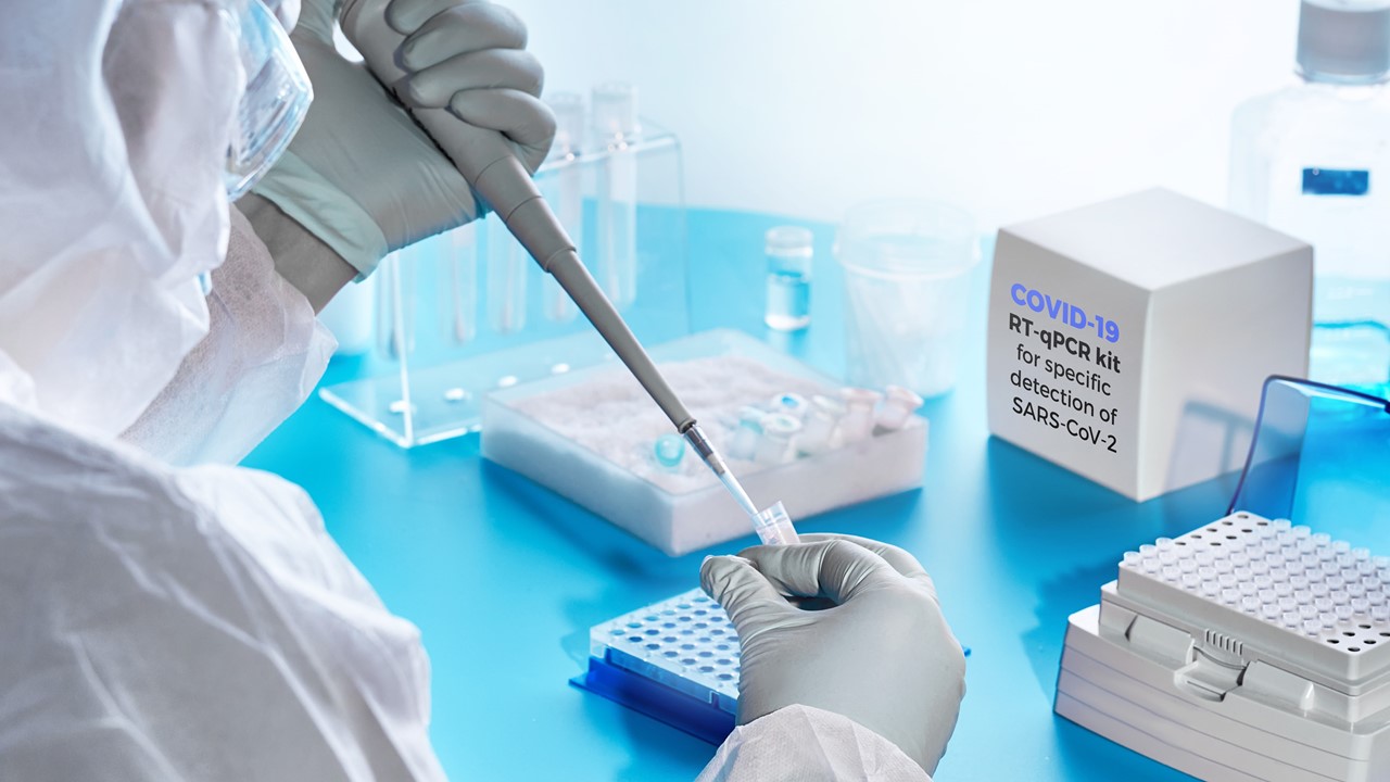 Pag-ulit ng RT-PCR test makalipas ang 14 na araw, hindi ipinapayo ng NAEFIC