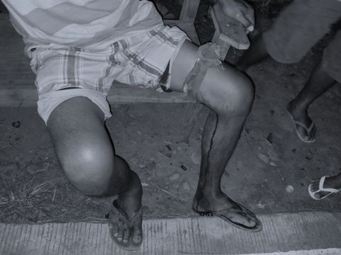 Brgy. Kagawad, 2 Tanod Sugatan matapos Hagisan ng Granada sa Outpost