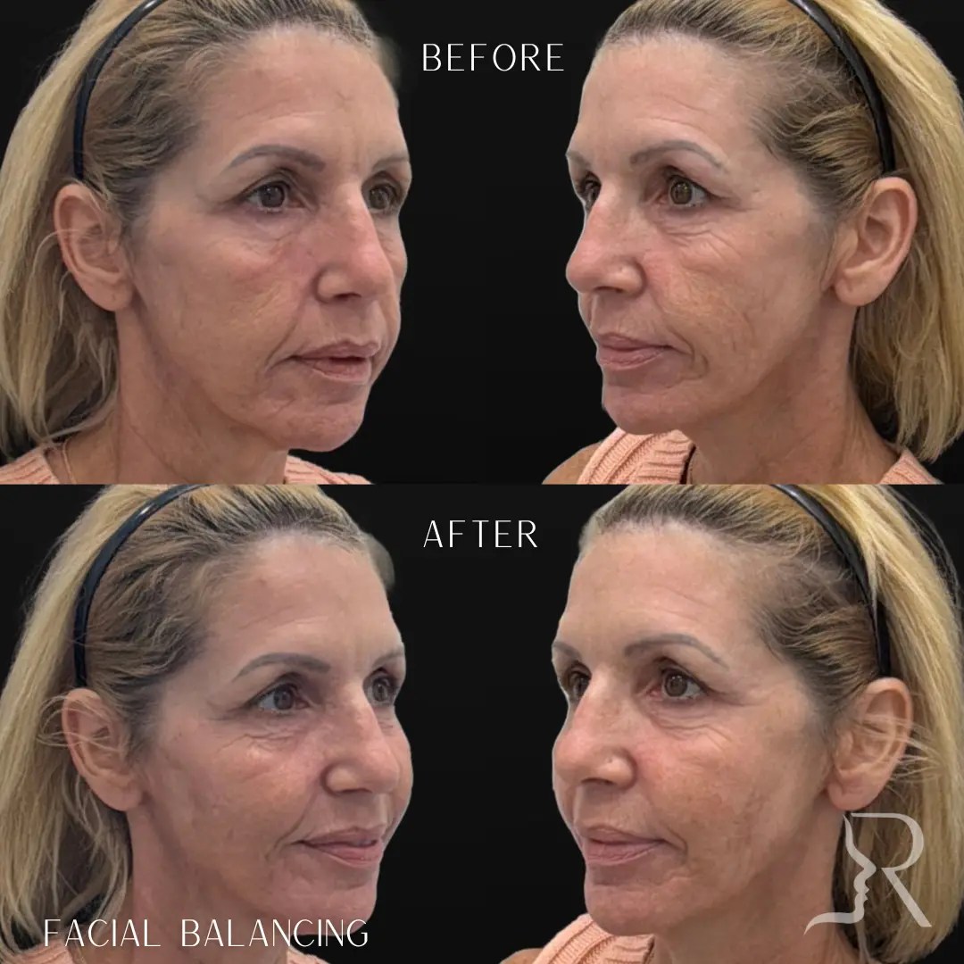 Before-After-2-1.webp