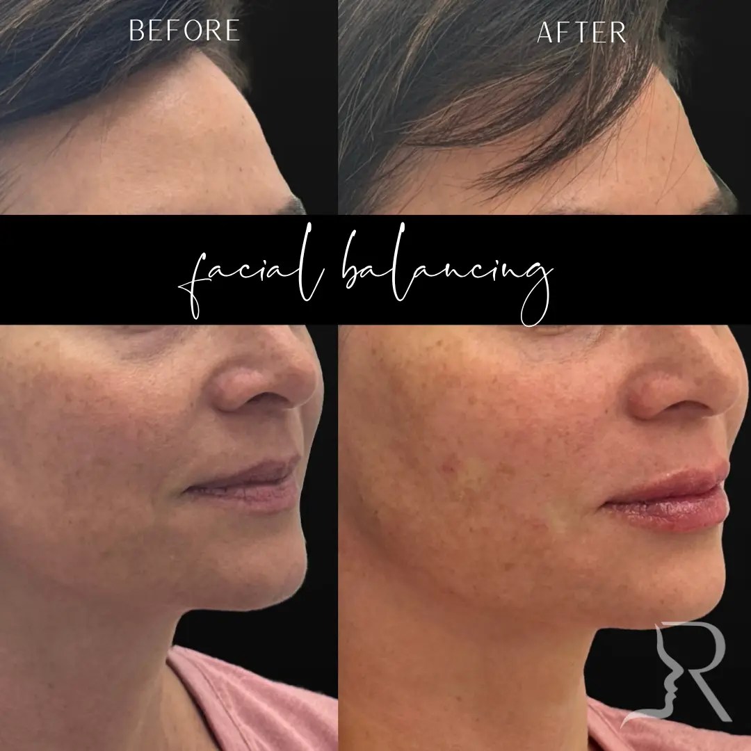 before-after-7-2.webp