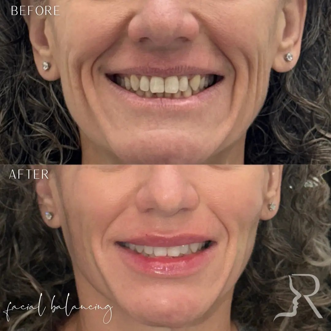 before-after-7.webp