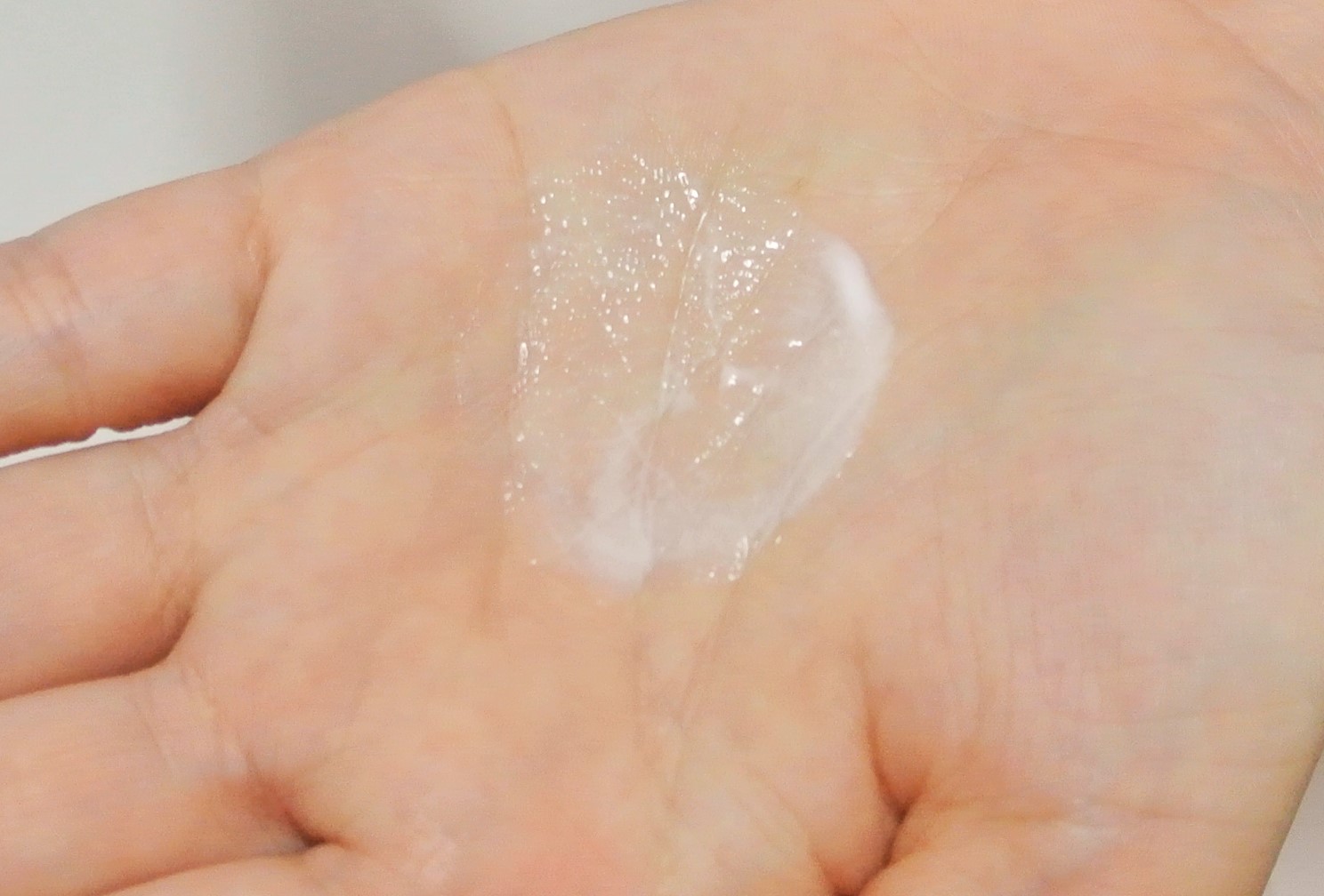 Refine Microdermabrasion