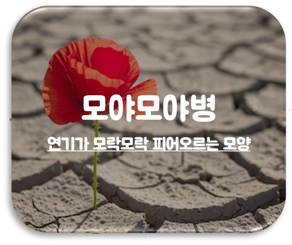 모야모야병