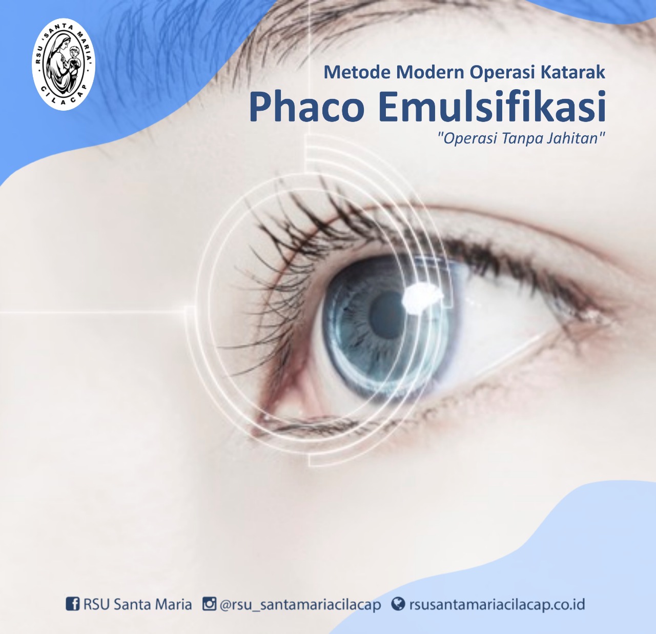 Metode Modern Operasi Katarak Phaco Emulsifikasi - RSU Santa Maria Cilacap