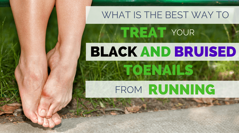 Can Diabetes Cause Toenails To Turn Black Scary Symptoms