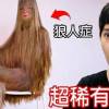 baixar 【尊】他們就是擁有0.001%罕見基因的「超稀有人類」! ? 下次進化可以記得帶上我嗎...? ?【第二頻道】 mp3
