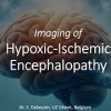 baixar Imaging of Hypoxic-Ischemic Encephalopathy mp3