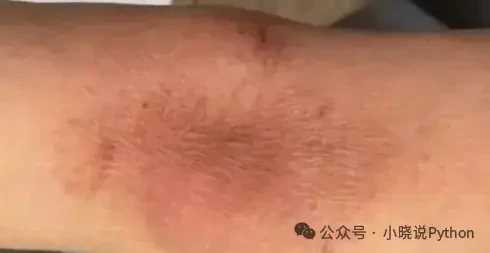 快訊 / 小S凌晨緊急送醫 （姐姐離世後第三次急診）
