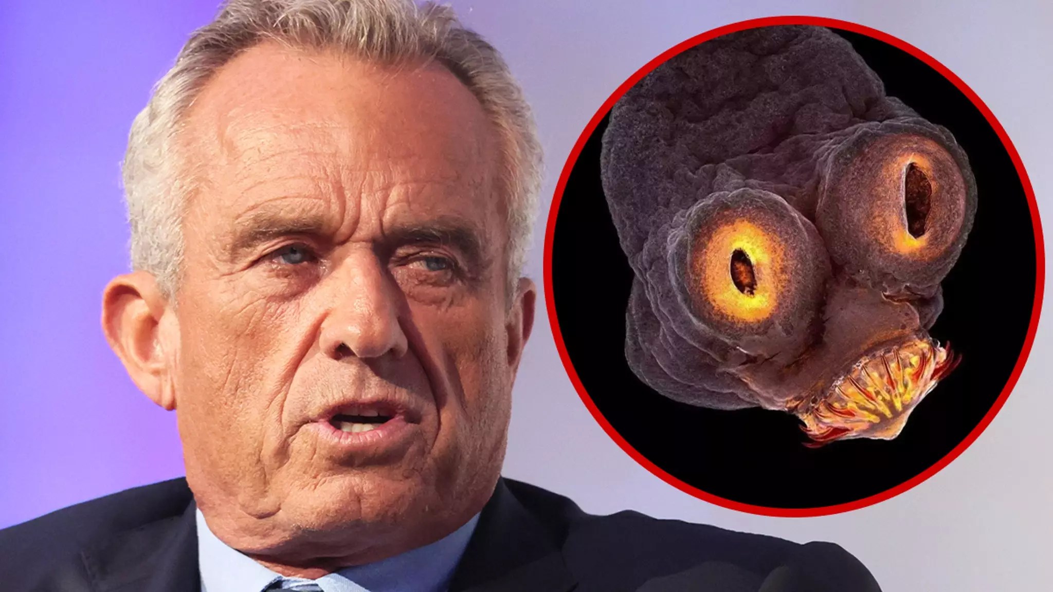 Robert F. Kennedy Jr. and the Brain Parasite Incident: A Critical Analysis
