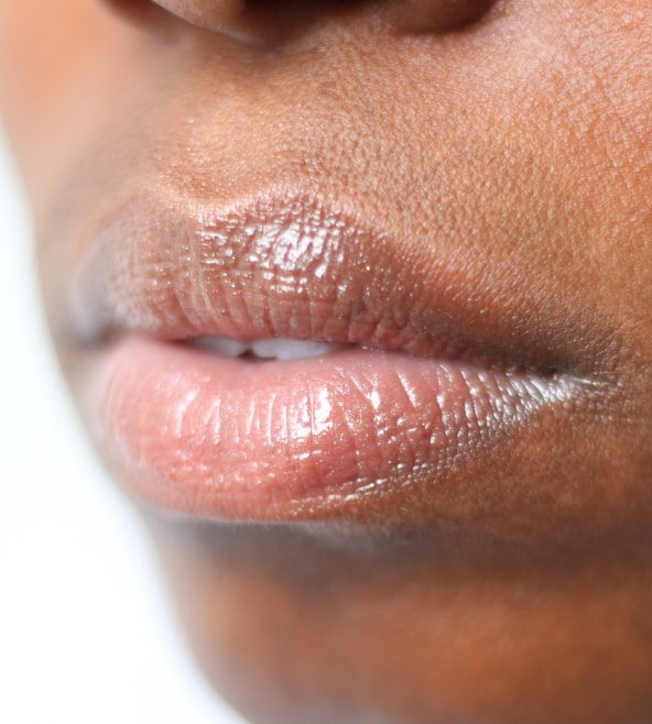 Itchy, dry, cracked, peeling — if you’ve had chapped lips before, you know how uncomfortable they can be. Lip Lift Overview Cost Recovery Before After Aedit