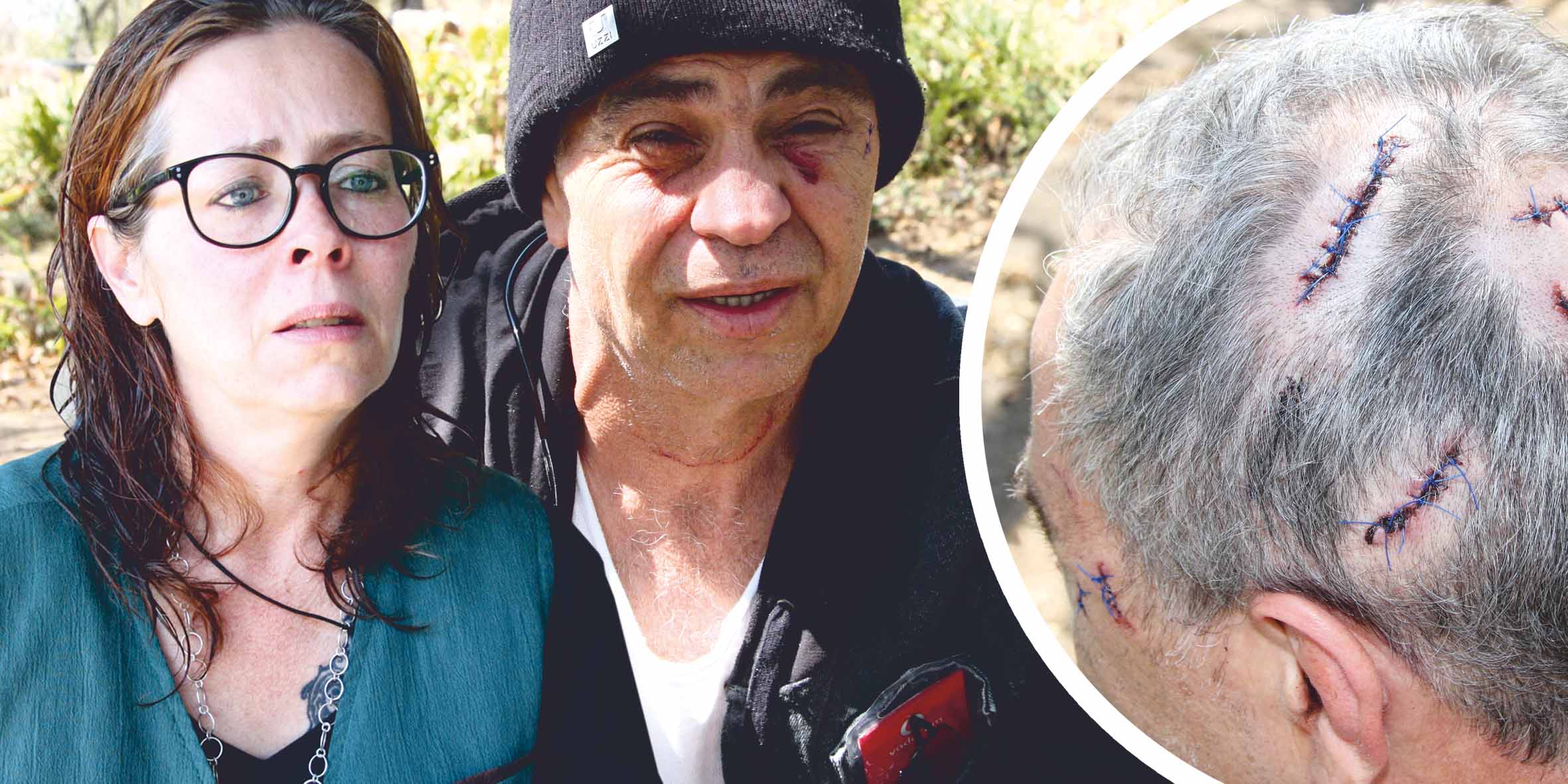 Yet another horror farm attack - victim lucky to be alive
