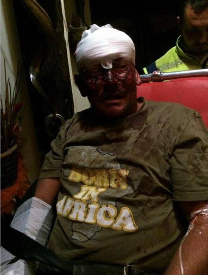 Family of Pretoria brutally attacked during house robbery