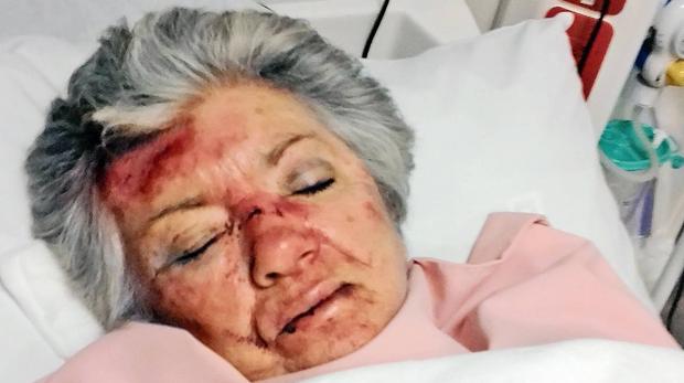 Vicious attack on elderly Kimberley resident