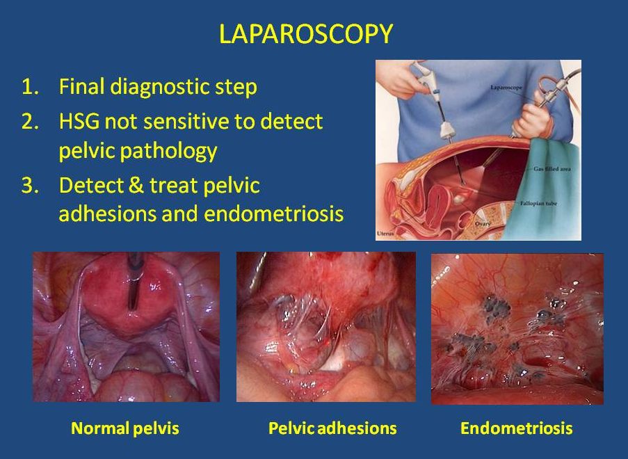 A pioneer in the field of undercover investigations and farm animal . Female Diagnostic Imaging - Irving, TX & Arlington, TX: IVFMD