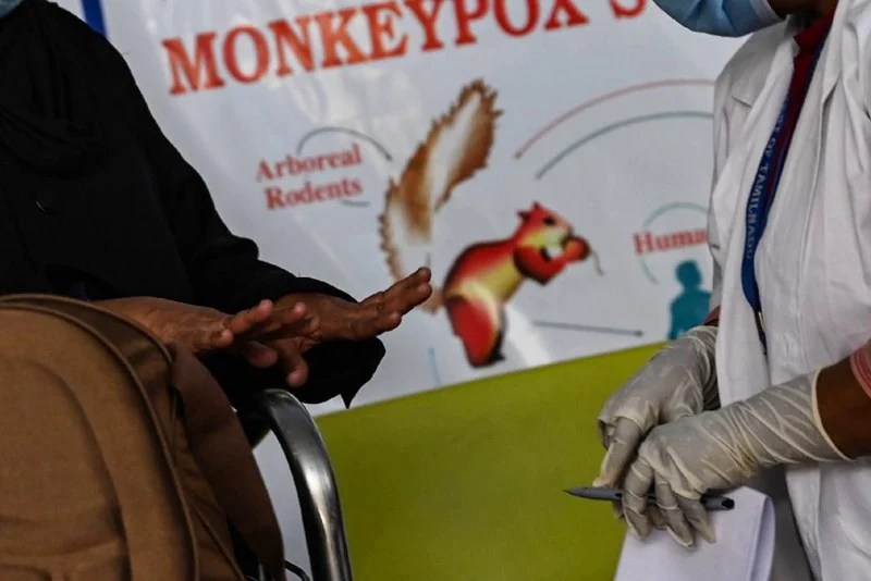 تسجيل أكثر من ألف إصابة بجدري القردة في أسبوع بجمهورية الكونغو الديمقراطية